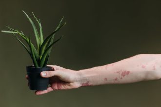 Psoriazisul: cum se manifestă și ce opțiuni de tratament există